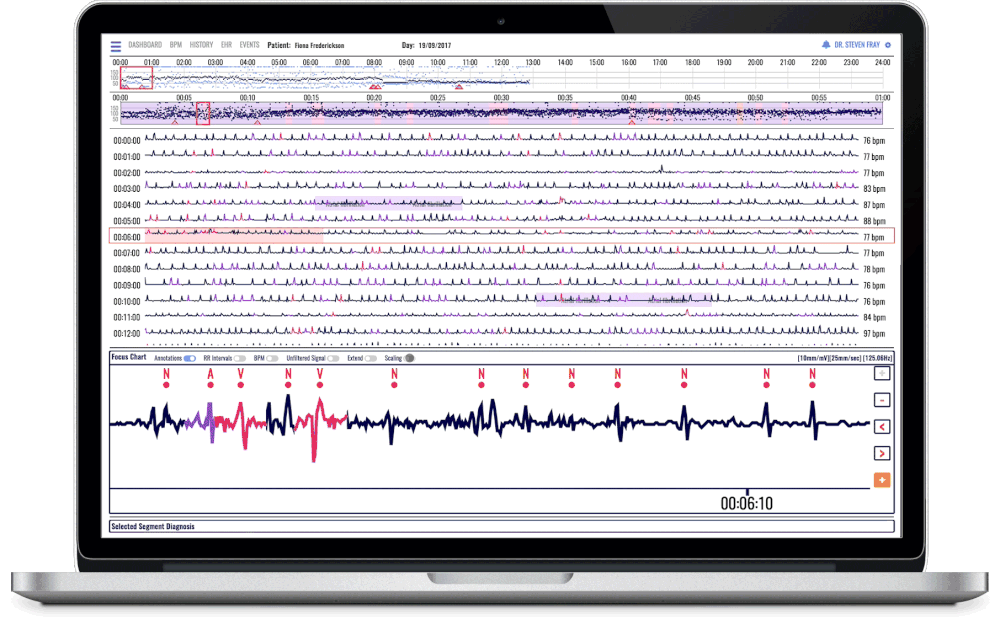 ECG Software